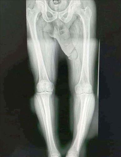 hẹn hò - Sakan -Male -Age:25 - Single-Thái Nguyên-Confidential Friend - Best dating website, dating with vietnamese person, finding girlfriend, boyfriend.